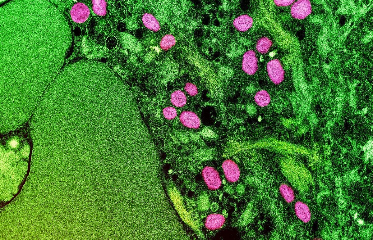 Новая оценка риска вспышки Mpox в Африке