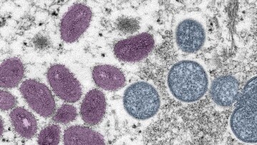 Всемирная организация здравоохранения объявила о вспышке мпокса как о чрезвычайной ситуации в области общественного здоровья