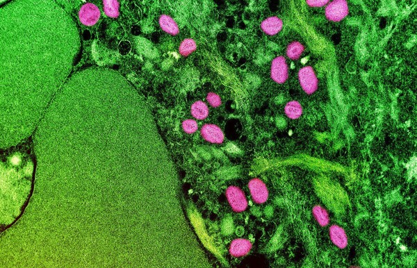 Новая оценка риска вспышки Mpox в Африке
